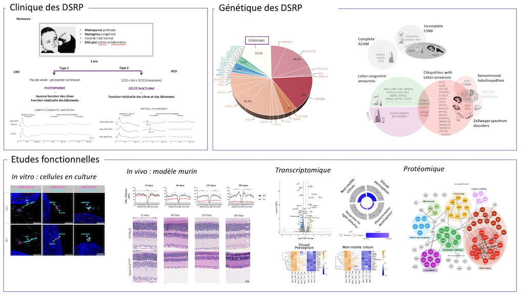 Génétique des dystrophies rétiniennes sévères et précoces 