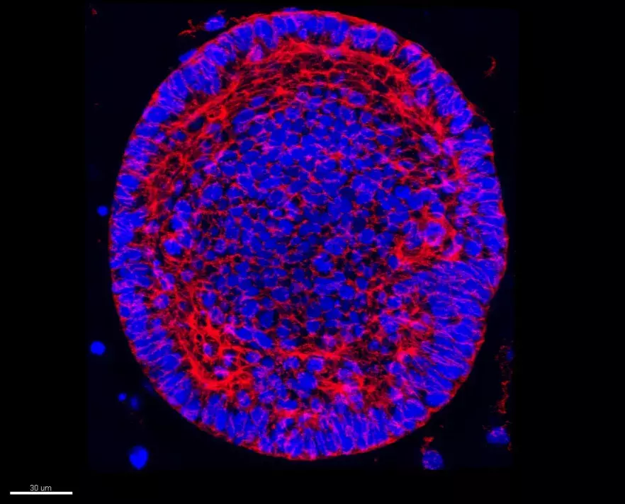 Human organoid CT