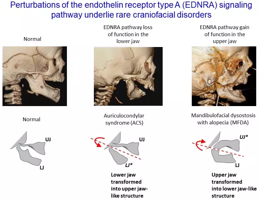 EDNRA pathway