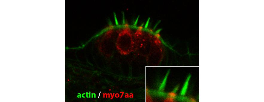 Myo7aa et actine dans les cellules sensorielles de l'oreille interne