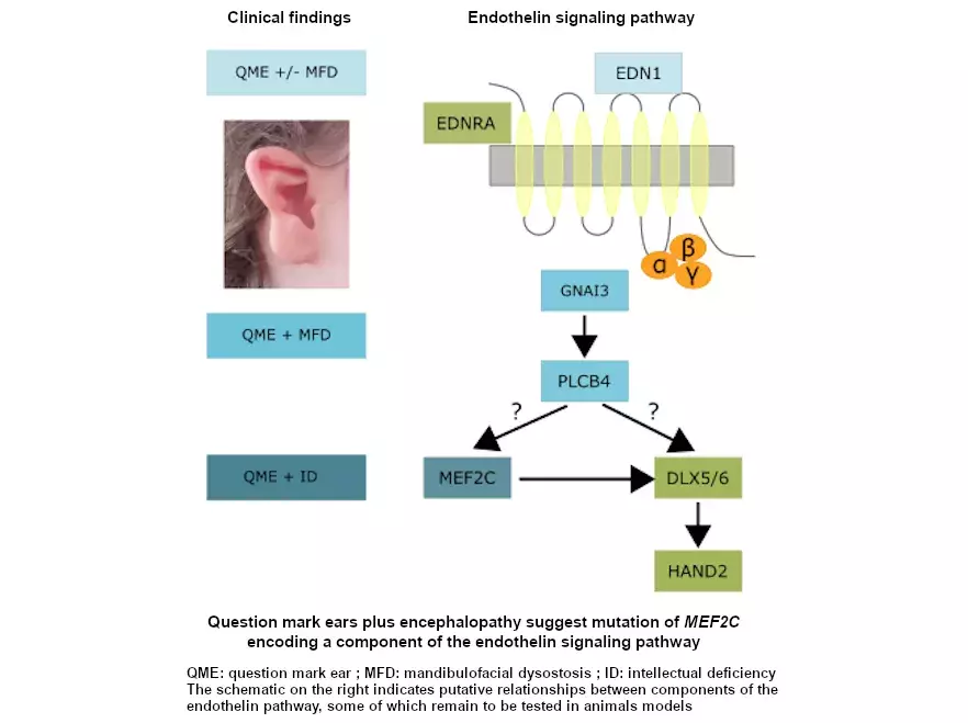 Endothelin signaling pathway