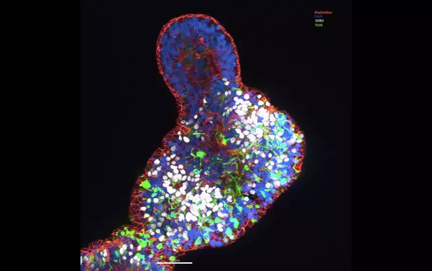 Mini brain obtenu après différenciation de cellules iPS