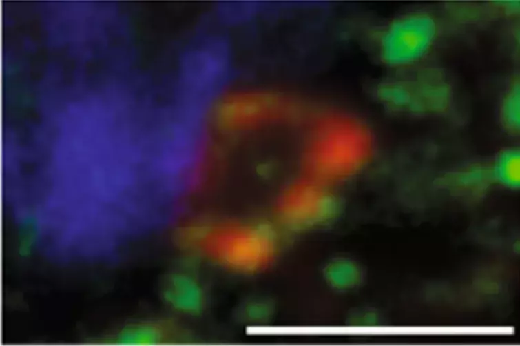 cellules dendritiques