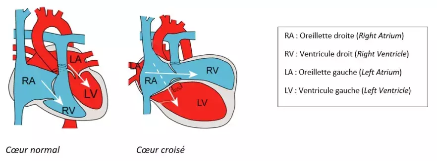 Crisscross heart 2