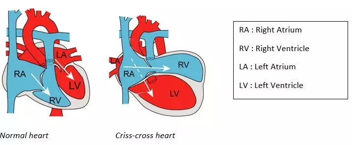 Crisscross heart EN